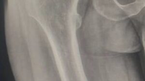  Campaign Image: Help Yusuf Ayuba heal from injuries doing pro-life ministry