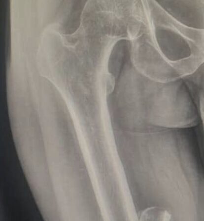 Featured Campaign Image: Help Yusuf Ayuba heal from injuries doing pro-life ministry