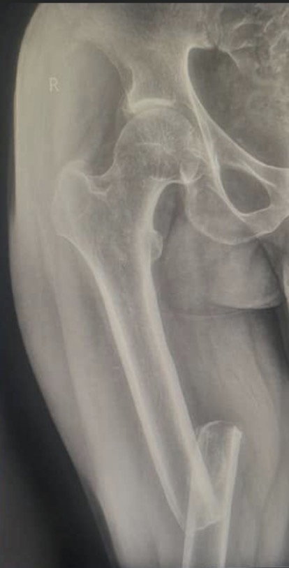 Help Yusuf Ayuba heal from injuries doing pro-life ministry