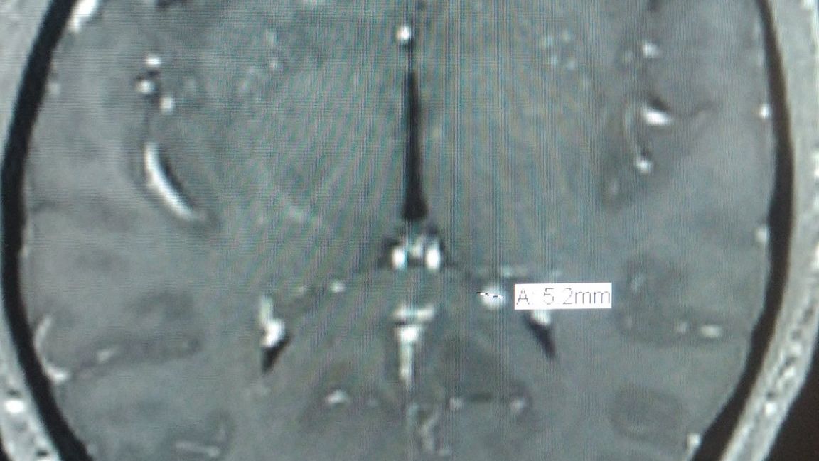 Tiki’s Brain Cancer And Life Issues Fund