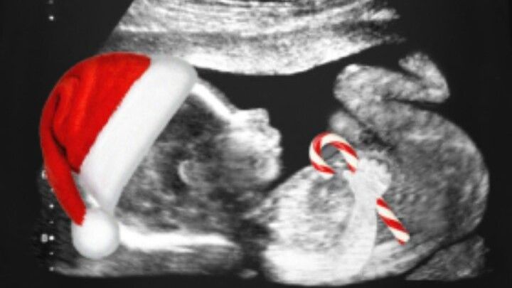 Christmas Gift For The Babies – CCBR Fundraiser!