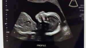  Campaign Image: 10 km Canada Day Run for the Pre-Born