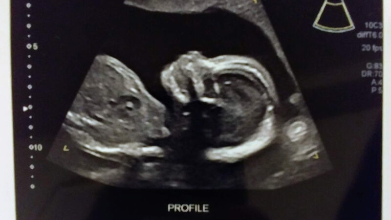 Featured Campaign Image: 10 km Canada Day Run for the Pre-Born