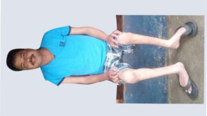  Campaign Image: Help Mathew Louis
